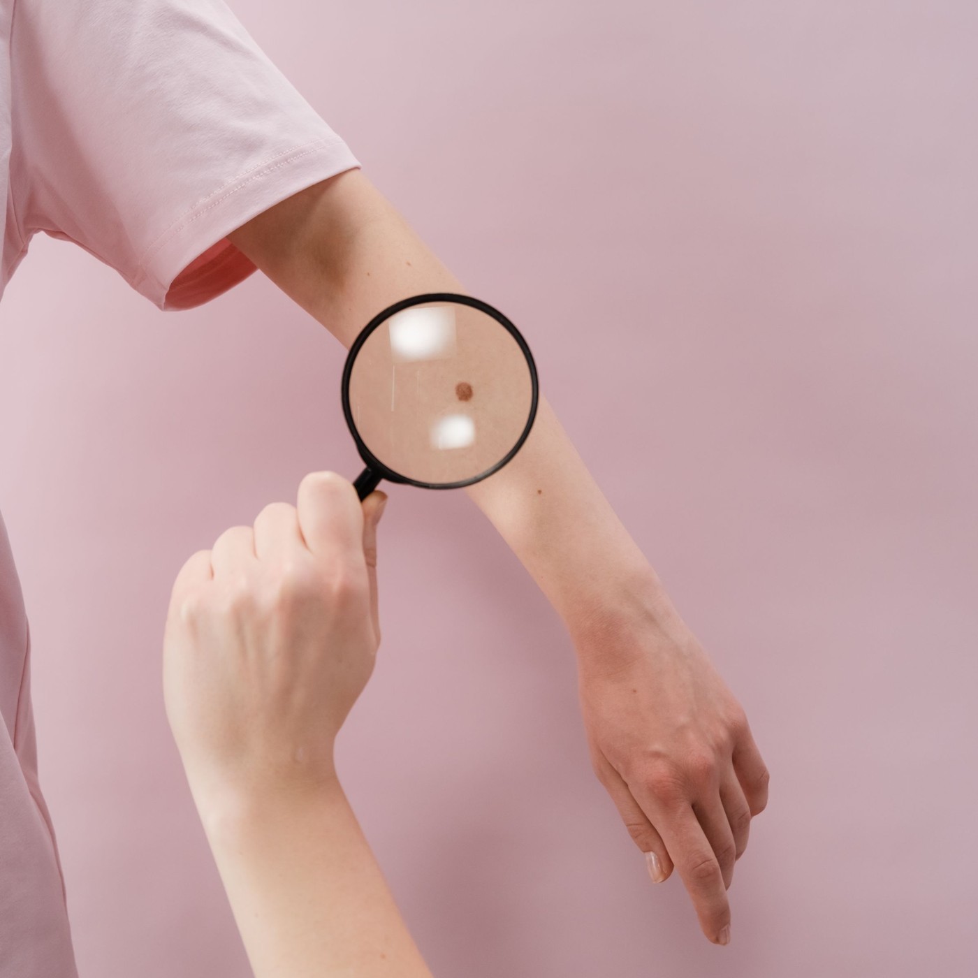 Avaliação dermatológica de pinta com lupa
